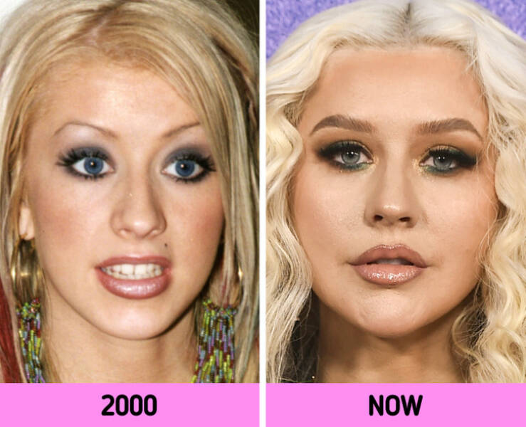 How Celebrity Faces Changed Over The Years