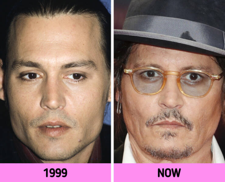 How Celebrity Faces Changed Over The Years