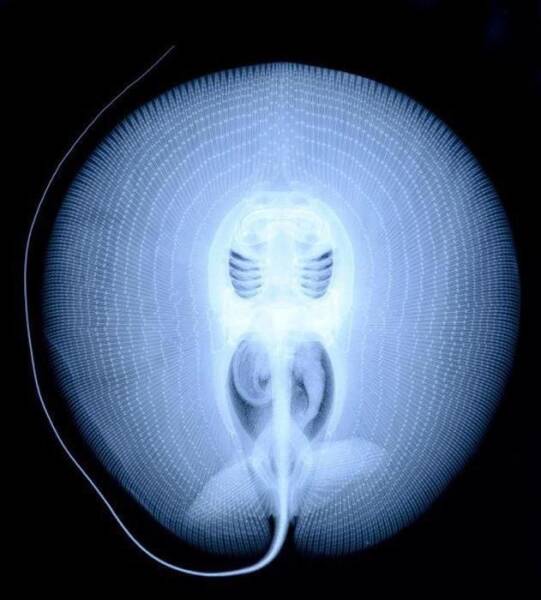 Random X-Rays Of Living Things