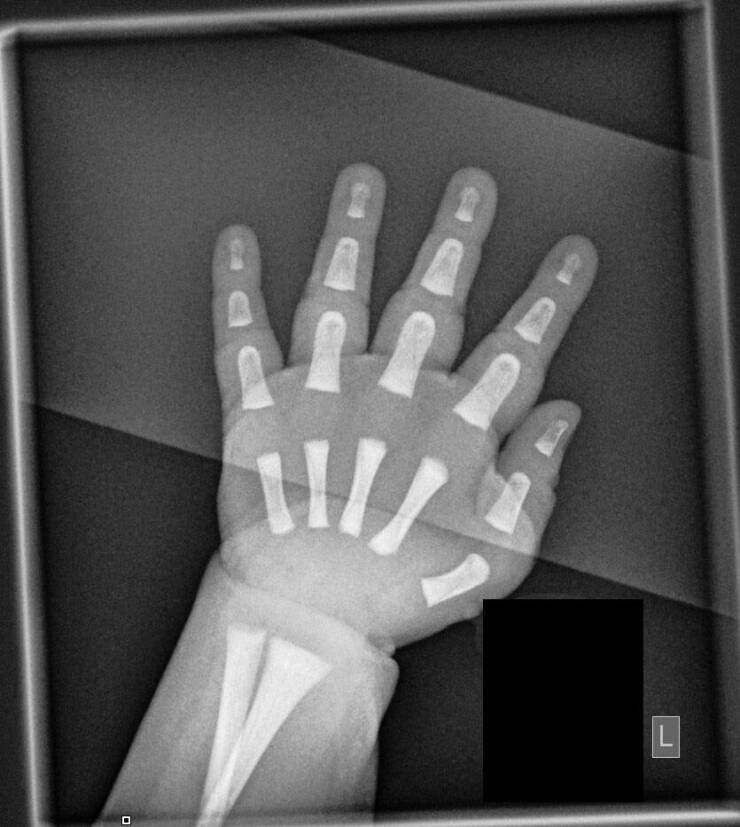 Random X-Rays Of Living Things