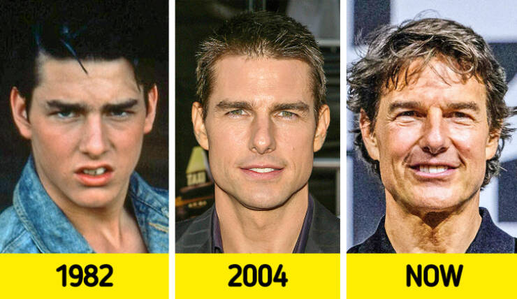 Celebrities: Back In Their Younger Days Vs Now