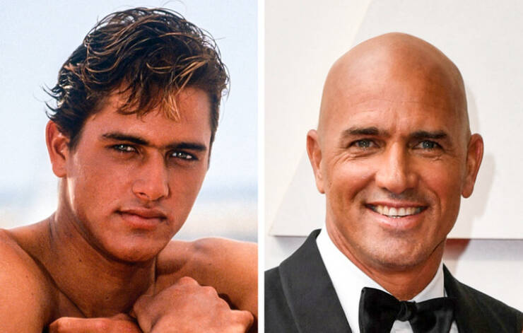 Famous Men Before Vs After Deciding To Go Bald
