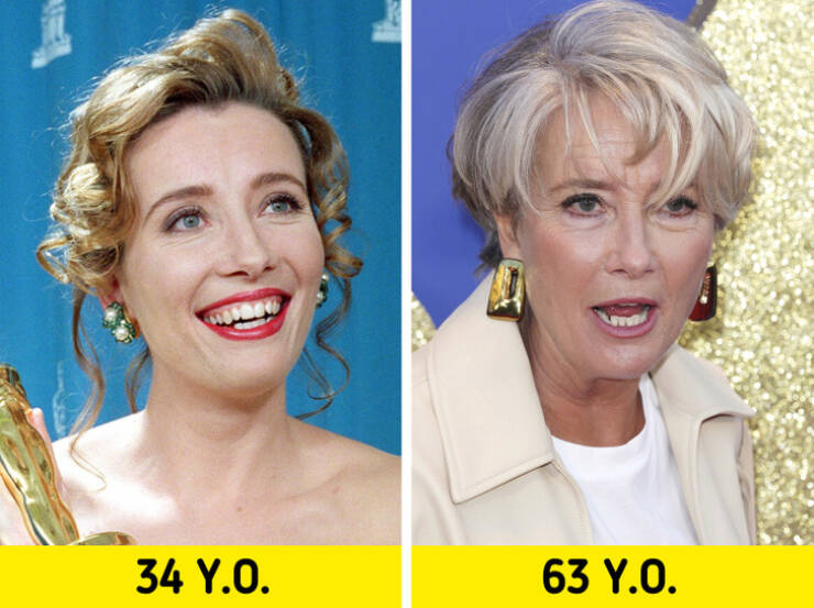 Celebrities Who Aren’t Afraid Of Natural Aging