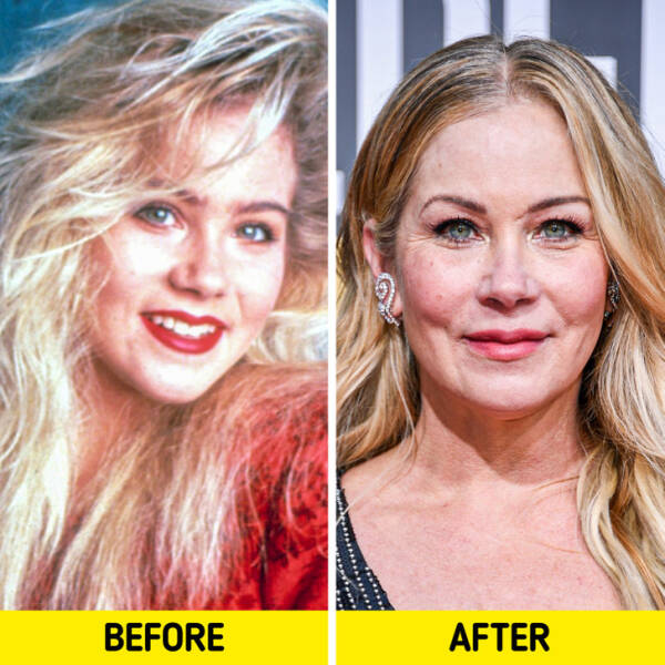 Celebrities From The 90s: Then Vs These Days