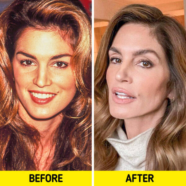 Celebrities From The 90s: Then Vs These Days