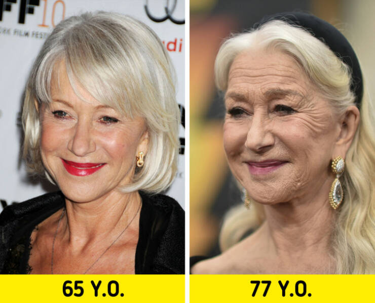The Beauty Of Age: Famous Women Who Proudly Show Their Wrinkles