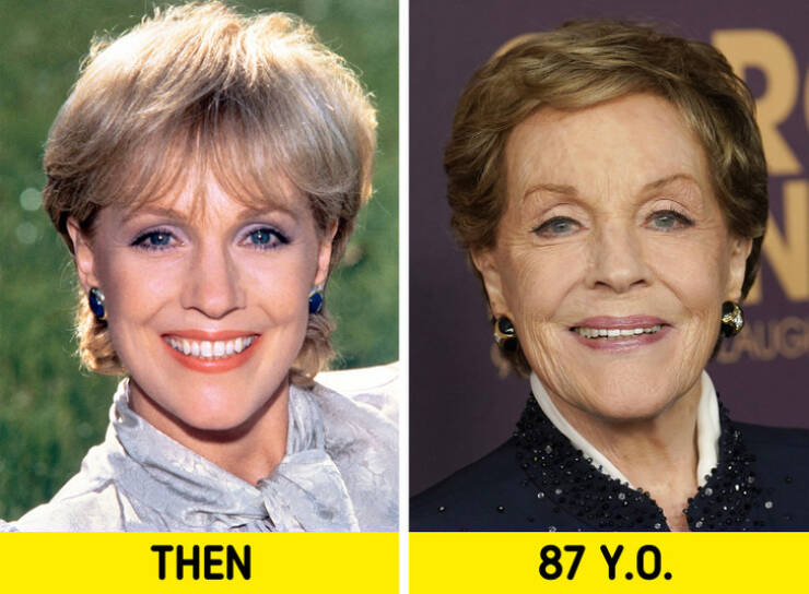 The Beauty Of Age: Famous Women Who Proudly Show Their Wrinkles