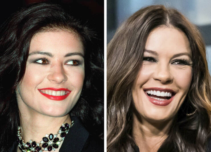 The Power Of A Smile: Celebrity Transformations