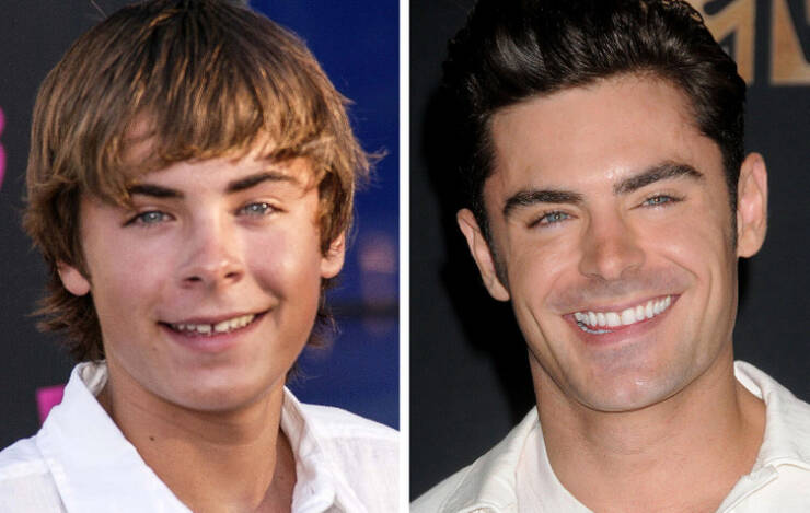 The Power Of A Smile: Celebrity Transformations