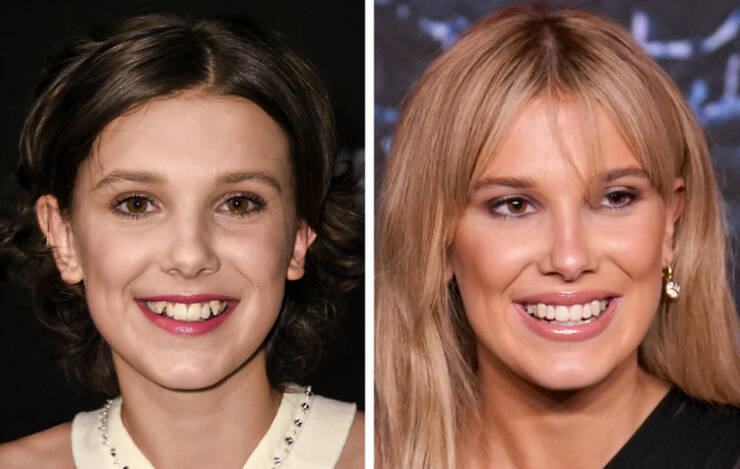 The Power Of A Smile: Celebrity Transformations