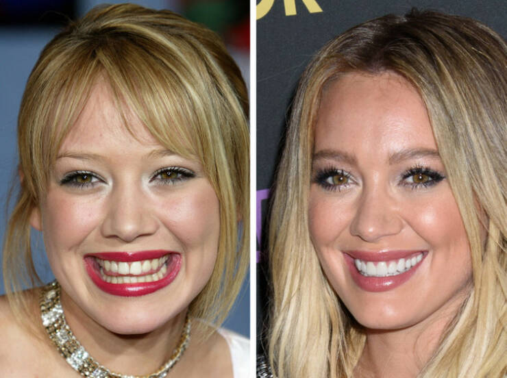 The Power Of A Smile: Celebrity Transformations