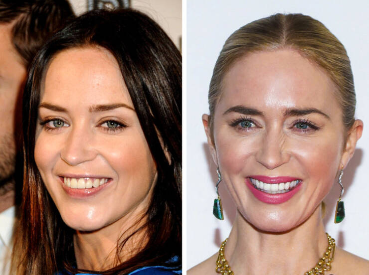 The Power Of A Smile: Celebrity Transformations