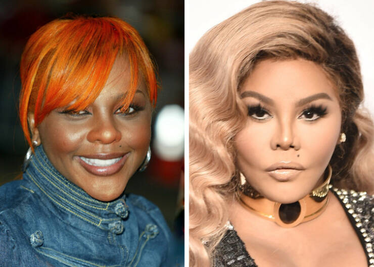 Before And After: Celebrity Makeovers Through Plastic Surgery