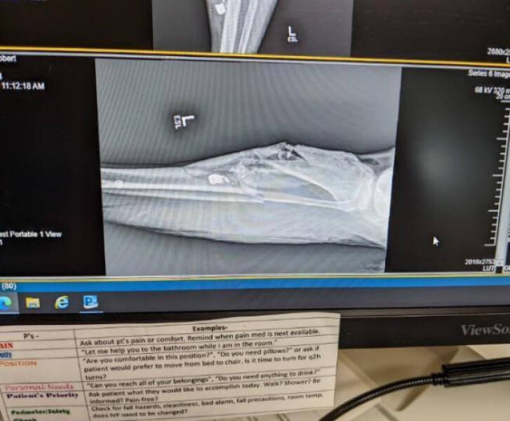 A Day Of Unluckiness: Witnessing How Things Can Go From Bad To Worse