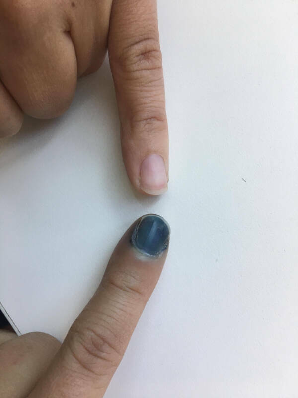 A Day Of Unluckiness: Witnessing How Things Can Go From Bad To Worse