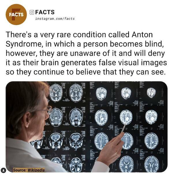 Unexpected Knowledge Bombs: Insane Facts That Will Leave You Awestruck