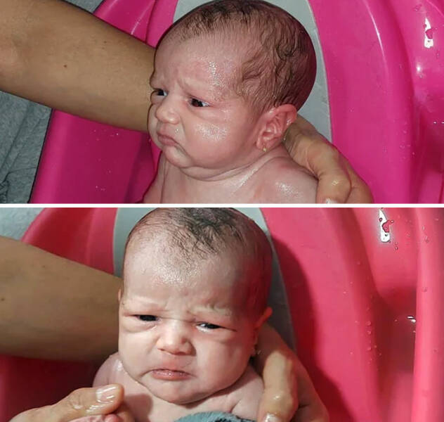 Beyond Their Years: Benjamin Button Babies Defying Age Norms