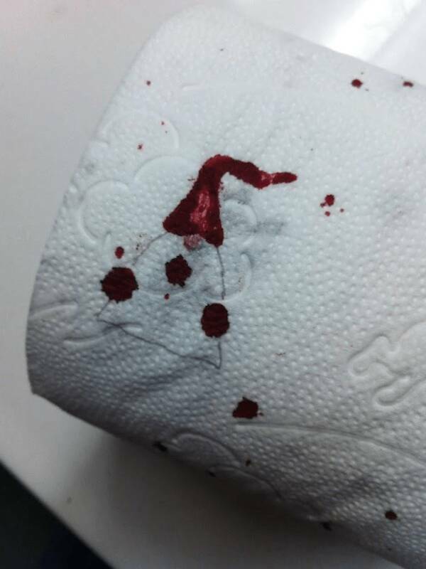 Ho-Ho-Oh No! Christmas Fails That Overshadow The Festivities