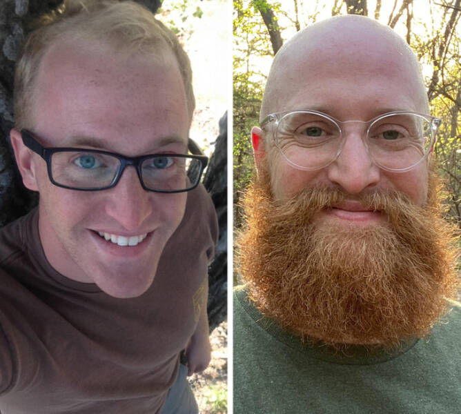 Whisker Wonders: The Metamorphosis Of Men Through Beards