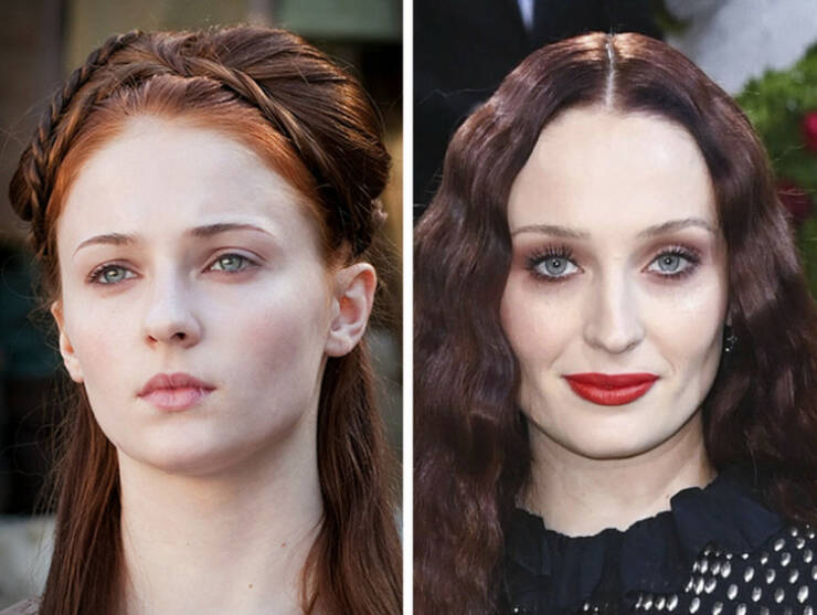 Cheekbone Chronicles: Celebrity Womens Transformative Facial Sculpting