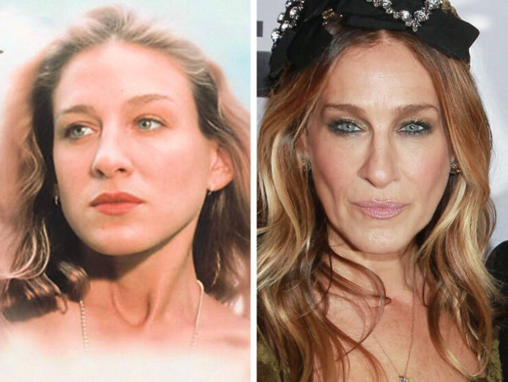 Cheekbone Chronicles: Celebrity Womens Transformative Facial Sculpting