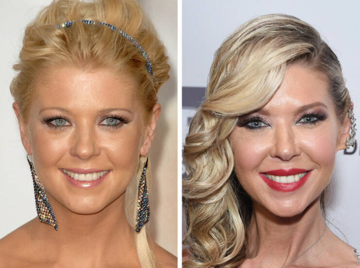 Star Metamorphosis: Celebrities Unrecognizable In Before-After Shots Star Metamorphosis: Celebrities Unrecognizable In Before-After Shots