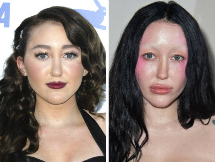 Star Metamorphosis: Celebrities Unrecognizable In Before-After Shots Star Metamorphosis: Celebrities Unrecognizable In Before-After Shots