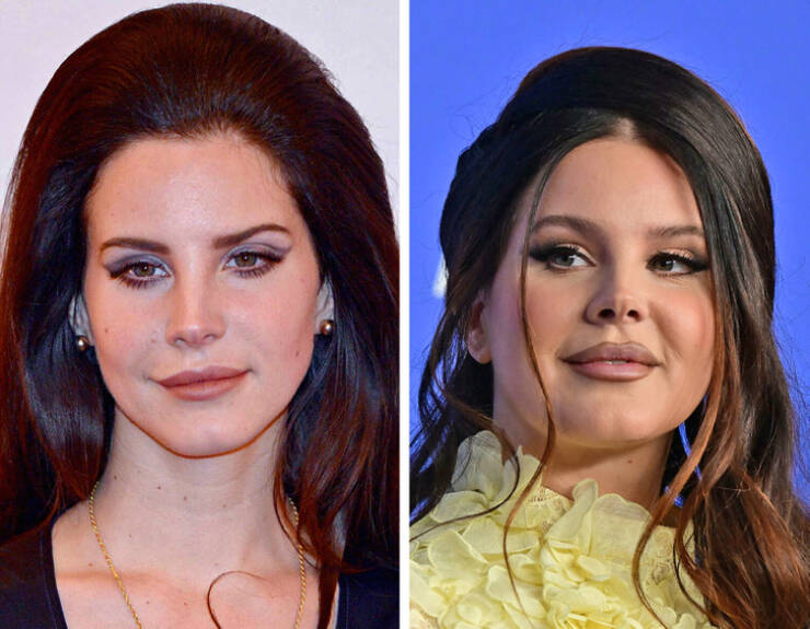 Star Metamorphosis: Celebrities Unrecognizable In Before-After Shots