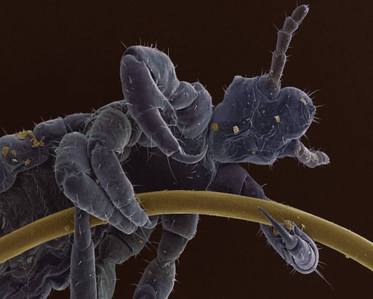 Microscopic Marvels: The Fascinating World Up Close