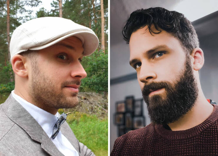 Beard Transformations That Will Make You Rethink Shaving