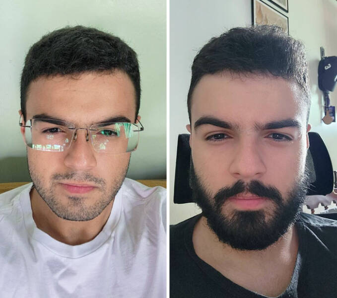 Beard Transformations That Will Make You Rethink Shaving