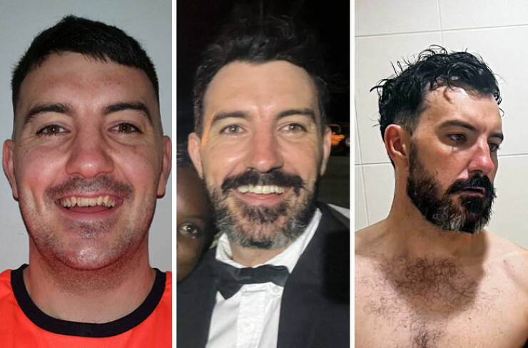 Beard Transformations That Will Make You Rethink Shaving