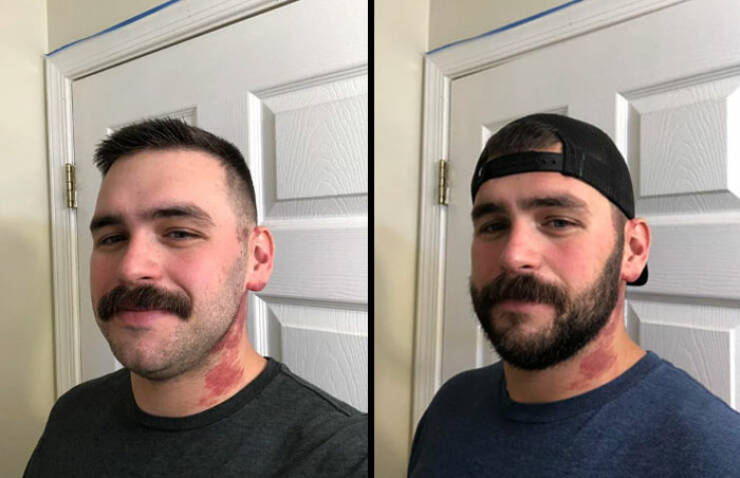 Beard Transformations That Will Make You Rethink Shaving