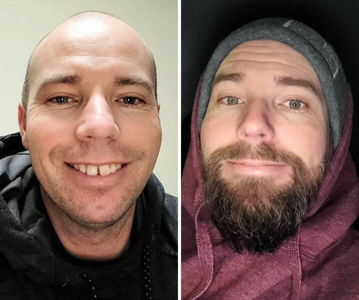 Beard Transformations That Will Make You Rethink Shaving