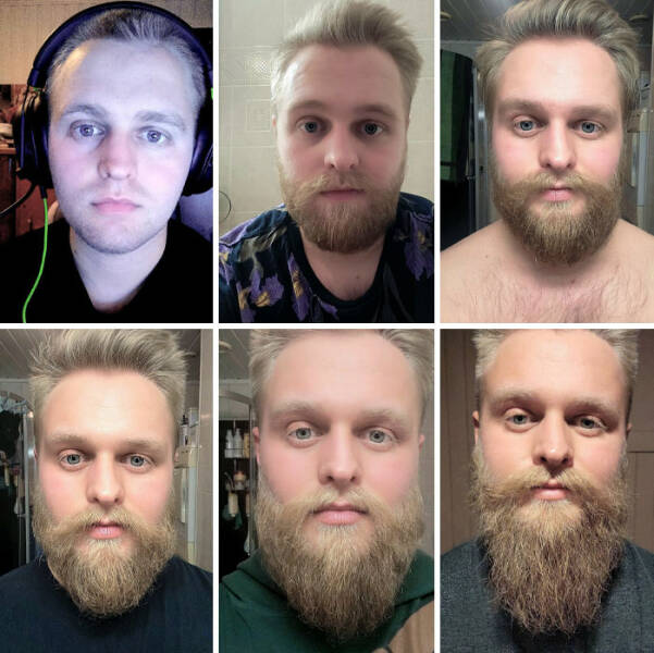 Beard Transformations That Will Make You Rethink Shaving