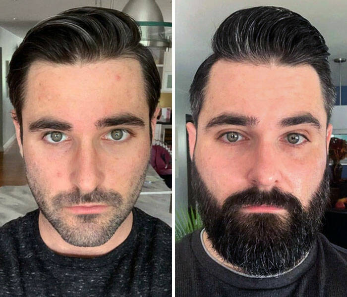 Beard Transformations That Will Make You Rethink Shaving