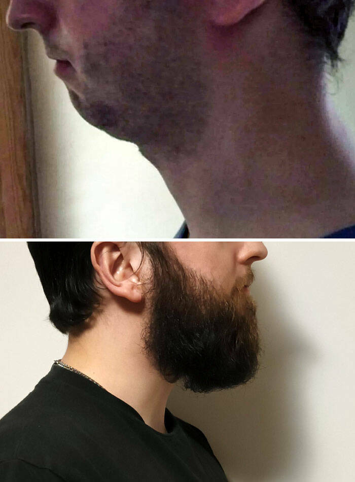 Beard Transformations That Will Make You Rethink Shaving