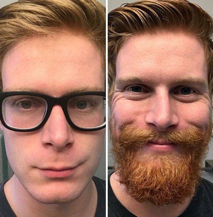 Beard Transformations That Will Make You Rethink Shaving