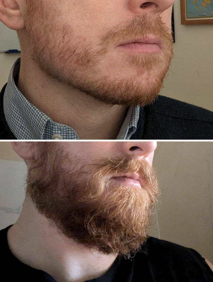 Beard Transformations That Will Make You Rethink Shaving