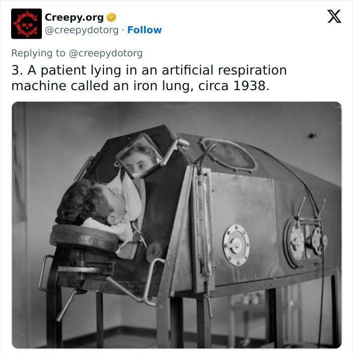 Historic Medical Treatments That Will Make You Cringe