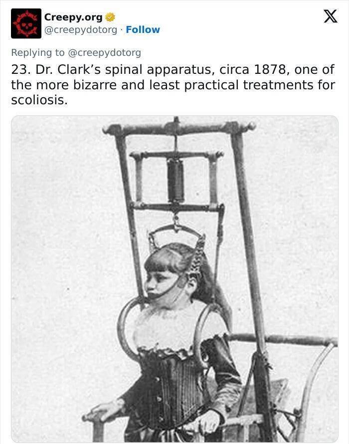 Historic Medical Treatments That Will Make You Cringe