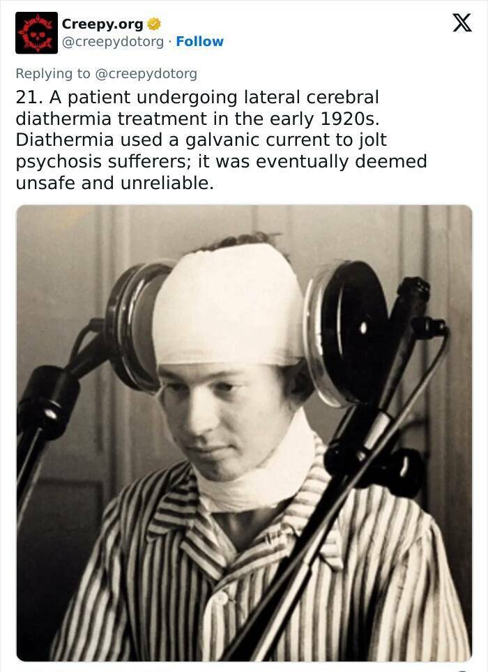 Historic Medical Treatments That Will Make You Cringe