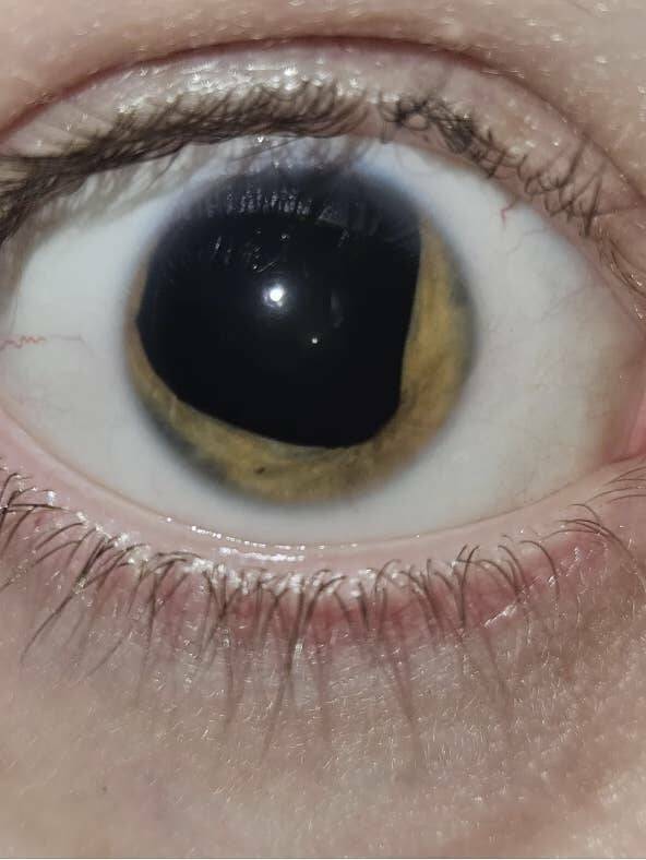 Terrifying Photos That Will Haunt Your Dreams