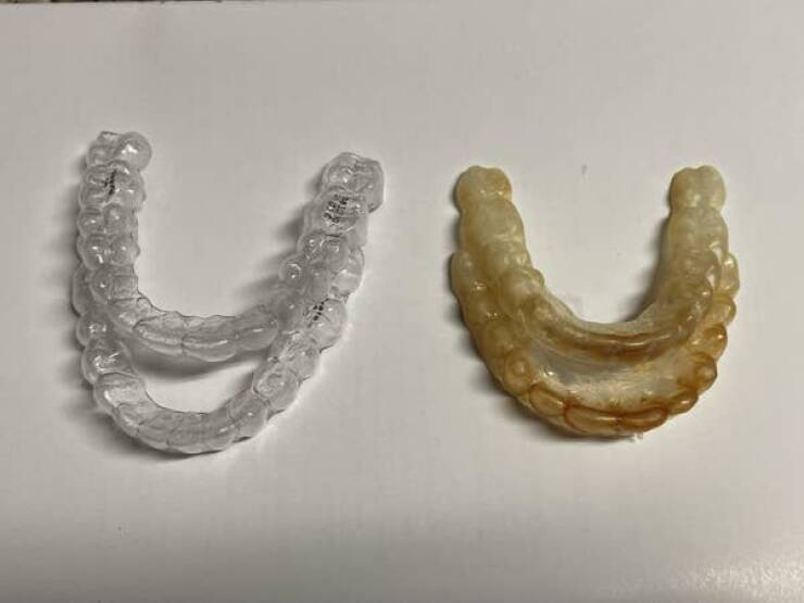 Well-Worn Objects That Tell A Story Through Before-and-After Shots