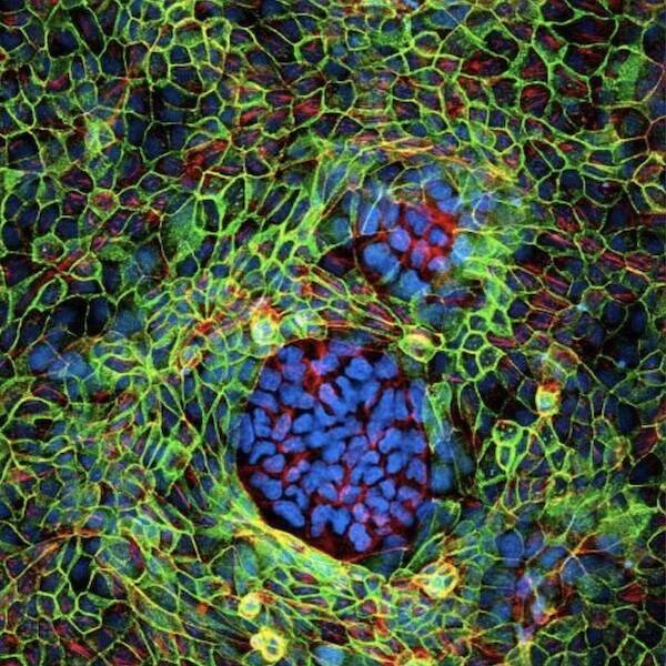 Terrifying Creatures You Can Only See Under A Microscope