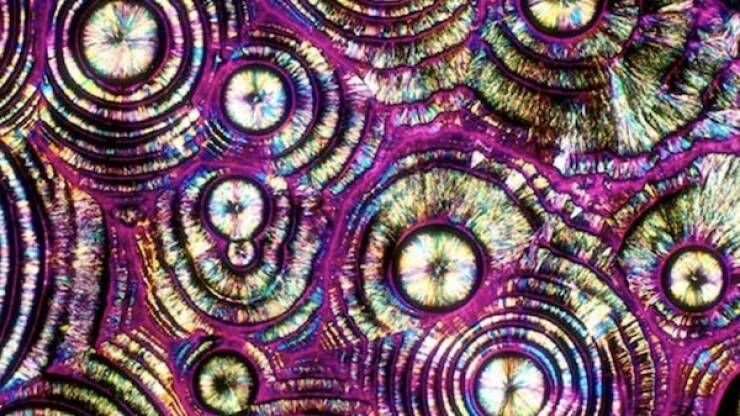 Terrifying Creatures You Can Only See Under A Microscope