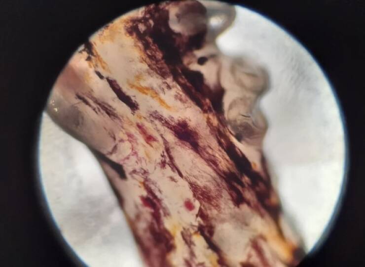 Terrifying Creatures You Can Only See Under A Microscope