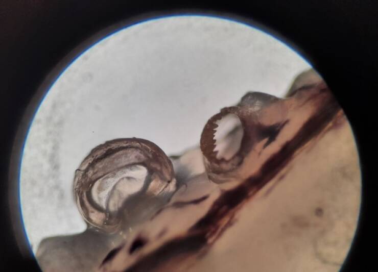 Terrifying Creatures You Can Only See Under A Microscope