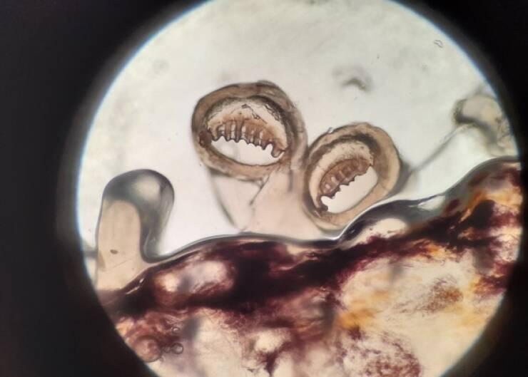 Terrifying Creatures You Can Only See Under A Microscope