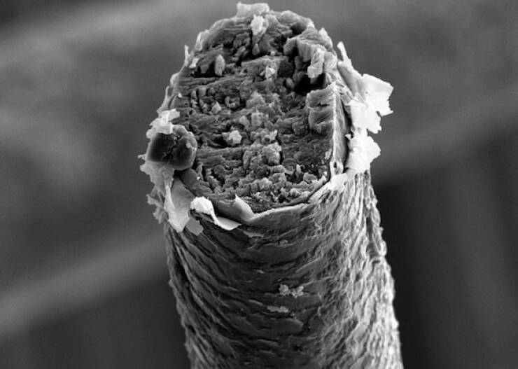 Terrifying Creatures You Can Only See Under A Microscope